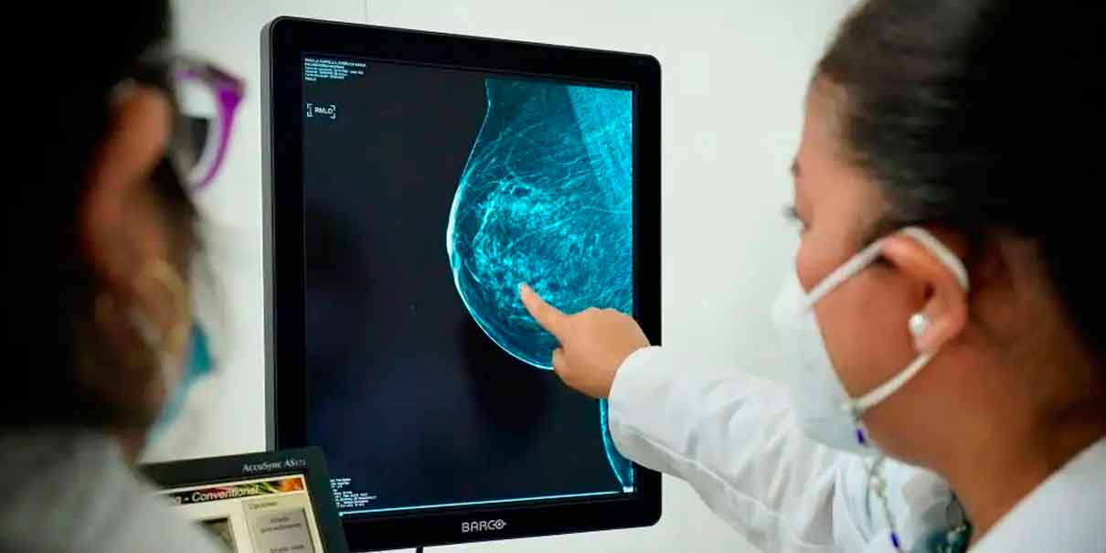 Pacientes con cáncer de mama deberían evitar estas dietas altas en grasa, advierten científicos