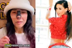 Dorismar reaparece tras someterse a una reconstrucción nasal luego de una cirugía estética fallida que afectó su respiración y la llevó a un proceso legal.