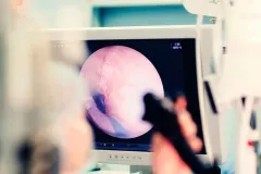 La bacteria vinculada al cáncer gástrico que porta gran parte de México