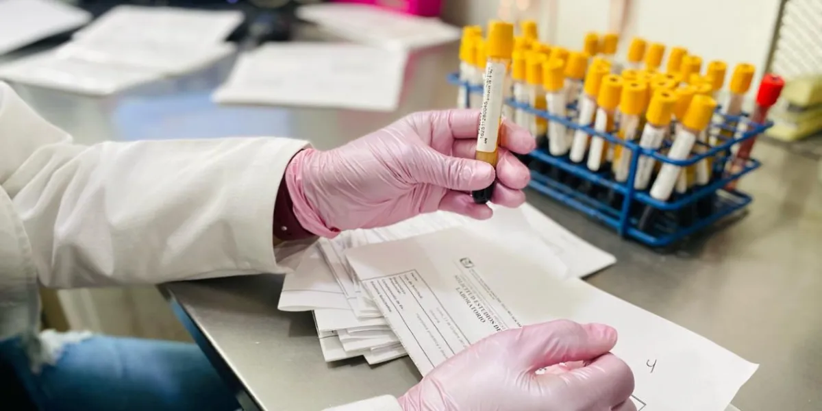 IMSS Morelos llama a la detección oportuna del cáncer de próstata