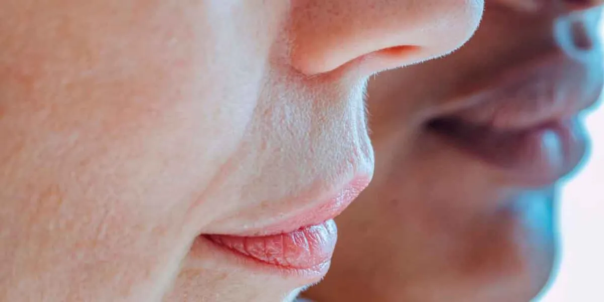 Cómo quitar las manchas del bigote sin empeorar el melasma