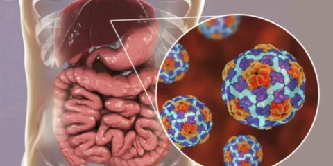 Registran casos de hepatitis en alumnos de secundarias
