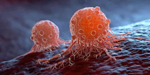 Cáncer, problema de salud y economía
