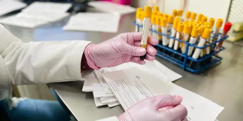 IMSS Morelos llama a la detección oportuna del cáncer de próstata