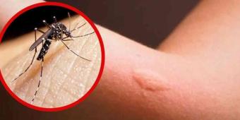 Población infantil, la más afectada por dengue: Dirección de Salud de Cuautla